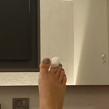 The X Belek Kaydıraktan Tırnaksız Çıktım!