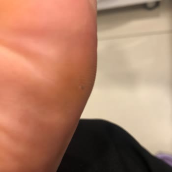 Stradivarius Markasının Sandalet Hüsranı