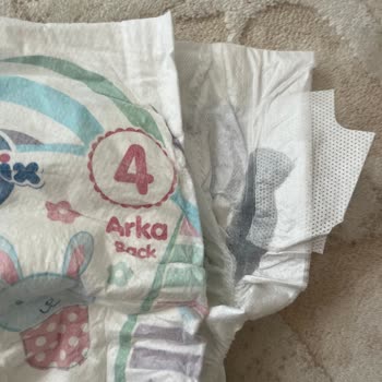 Molfix Bebek Bezinde Yabancı Madde Çıktı