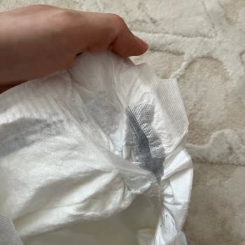 Molfix Bebek Bezinde Yabancı Madde Çıktı