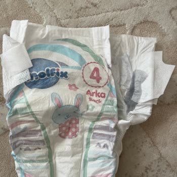 Molfix Bebek Bezinde Yabancı Madde Çıktı