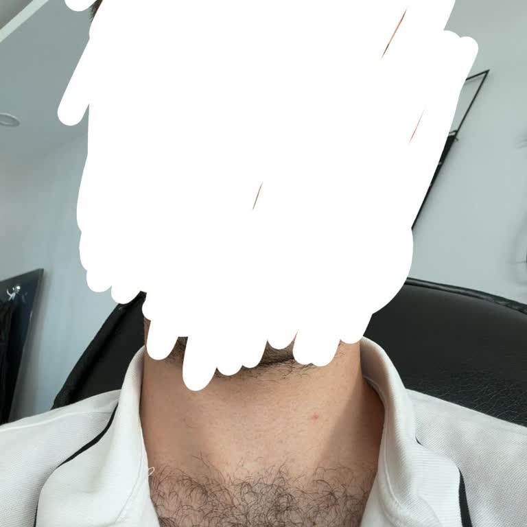 İnternal Güzellik Salonu Kıllarım Eskisinden Daha Uzun