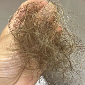 Eminem Peruk Saç Kaynak Rezil Saçları Döküldü