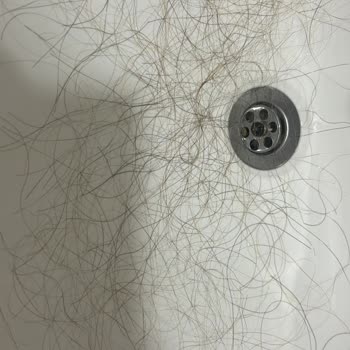 Eminem Peruk Saç Kaynak Rezil Saçları Döküldü