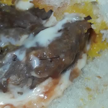 Köfteci Yusuf Hamburger Köftesine Saplanmış Kıl.