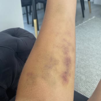 Medical Park Hastanesi Kocaeli Acil Bölümü Kan Alma