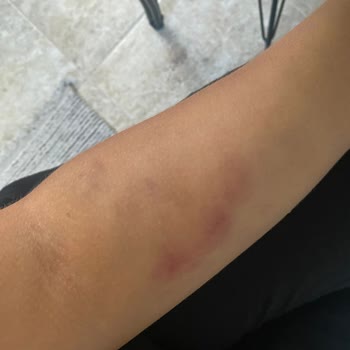 Medical Park Hastanesi Kocaeli Acil Bölümü Kan Alma