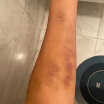 Medical Park Hastanesi Kocaeli Acil Bölümü Kan Alma