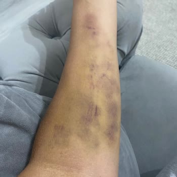 Medical Park Hastanesi Kocaeli Acil Bölümü Kan Alma