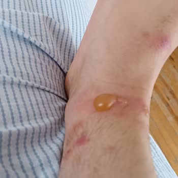 Medicana Hospitals Sivas'ta Dermatolog Deneyimi