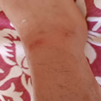 Medicana Hospitals Sivas'ta Dermatolog Deneyimi