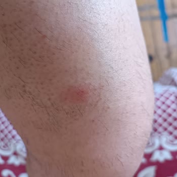 Medicana Hospitals Sivas'ta Dermatolog Deneyimi