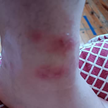 Medicana Hospitals Sivas'ta Dermatolog Deneyimi