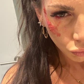 Pop Beauty Allık Yüzümde Patladı!