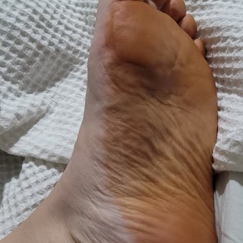 Birkenstock ich habe Risse und verfärbte Sohlen bei meinen Sandalen