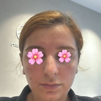 Eki aç