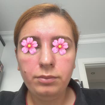 Eki aç