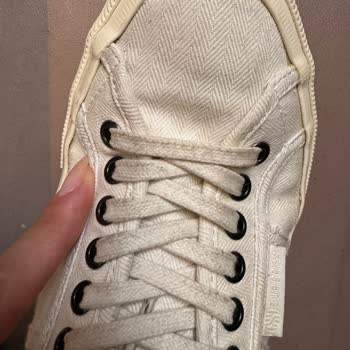 Superga İlgisizlik Ve Kalitesizliği