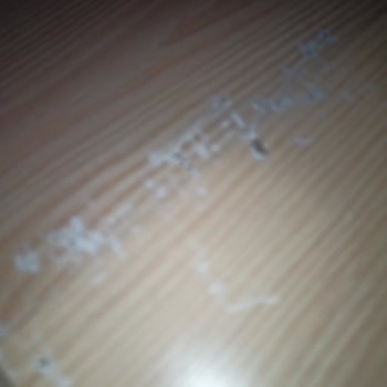 Vivense Frido Köşe Koltuk Çökme Ve Ayaklarında Sorun