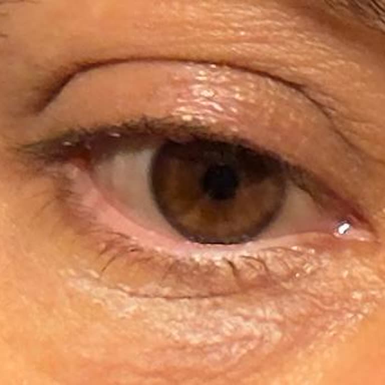 The Purest Solutions Göz Çevresi Serumu Kireç Gibi Oluyor