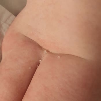 Sleepy Bebek Bezi Rengi Soluk Ve Pişik Yapıyor