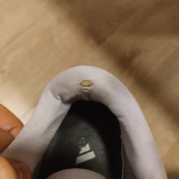 Adidas Ayakkabı Çok Çabuk Yırtıldı.