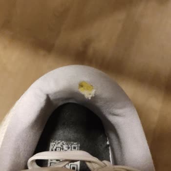 Adidas Ayakkabı Çok Çabuk Yırtıldı.