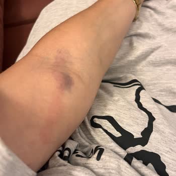 Medipol Sağlık Grubu Hastaneden Hiç Beklemezdim