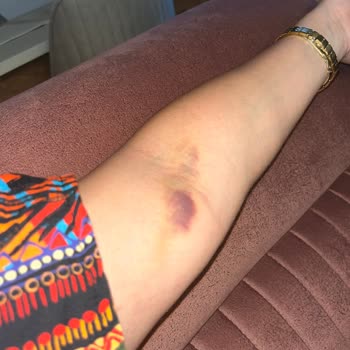 Medipol Sağlık Grubu Hastaneden Hiç Beklemezdim