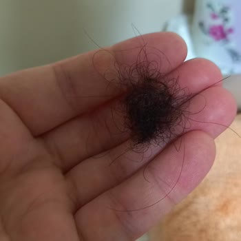 Loreal Paris Elseve Şampuan Saçlarımı Döktü