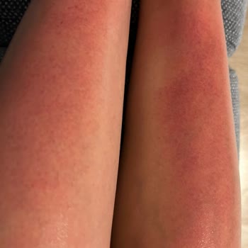 Eda Taşpınar Bronzlaştırıcı Sprey, Kullanma