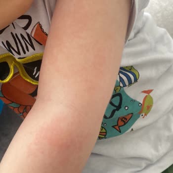 Dermoailem Sahte Ürün Satışı