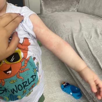 Dermoailem Sahte Ürün Satışı