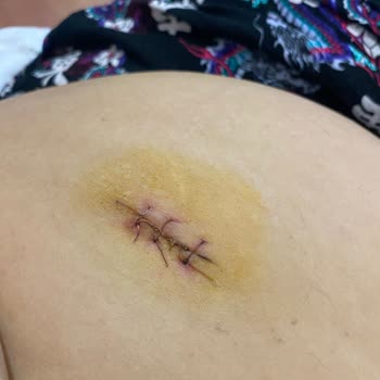 Medicana Hospitals Hastane Ve Doktor Deneyimim