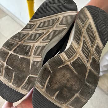 Skechers Türkiye Sorumsuzluğuna Birinci Elden Şahit Olmuş Durumdayım.