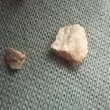 Güngören Belediyesi Diş Kıran Aşure