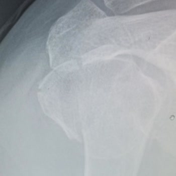 İstanbul Şafak Hastanesi Yanlış Teşhis Sonucu Yaşanan Mağduriyet