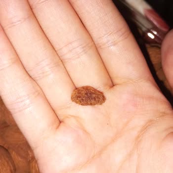 Bilvanis Kuruyemiş Kurtlu Badem Ve Çürük Fındıklar