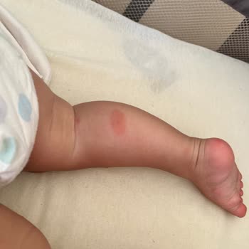 Nurse Harvey’s Bebek Sinek Koruyucu Sprey