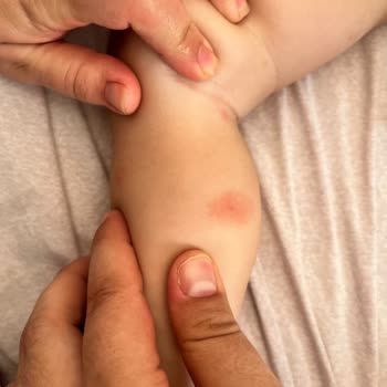 Nurse Harvey’s Bebek Sinek Koruyucu Sprey