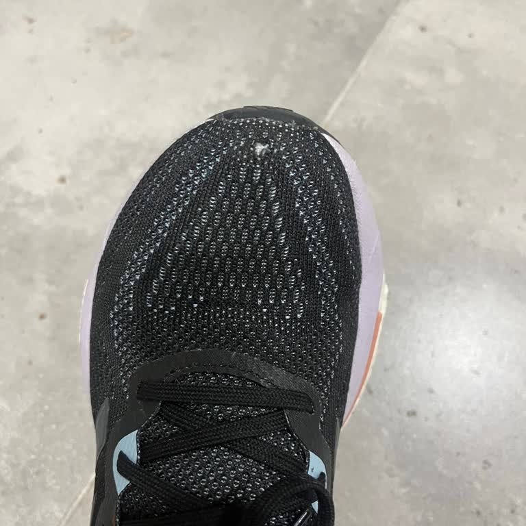 Adidas Türkiye Ürününün Arkasında Durmuyor