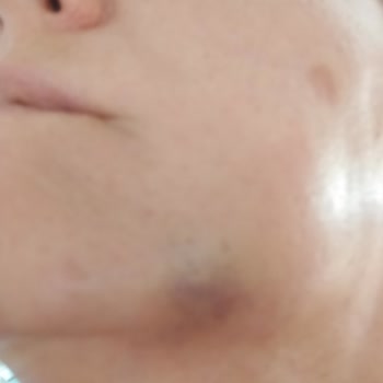 Dentopol Ağız ve Diş Sağlığı Dentapol Diş Hastanesi Maltepe