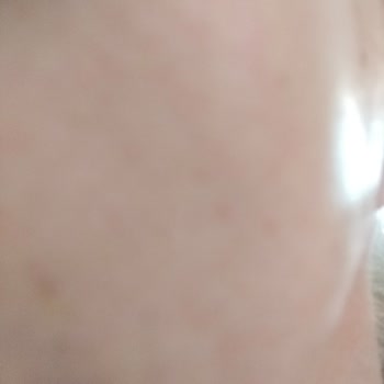 Dentopol Ağız ve Diş Sağlığı Dentapol Diş Hastanesi Maltepe