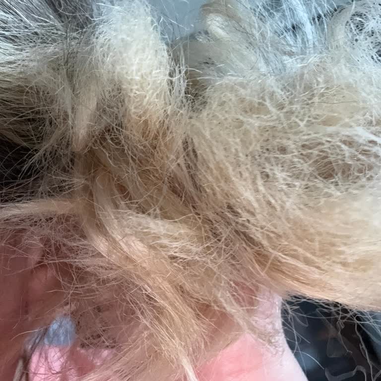 Kaan Karakaya Hair Studio (Isparta) Saçlarım Kopuyor