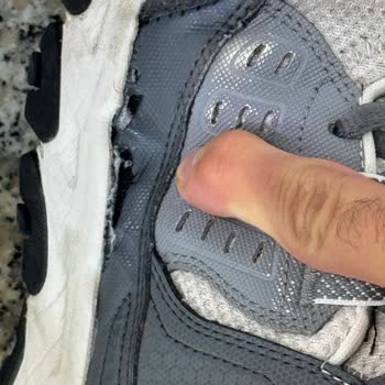Skechers Ayakkabı Sorunu Ve Çözülmüyor