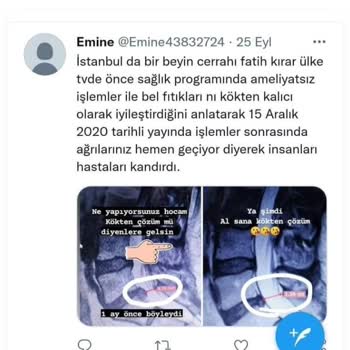 Op. Dr. Fatih Kırar Ameliyatsız İşlemler Asılsızdır