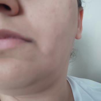 Trendyol Market Mağduru Trendyol Market Alışverişini Yapmasın Kimse