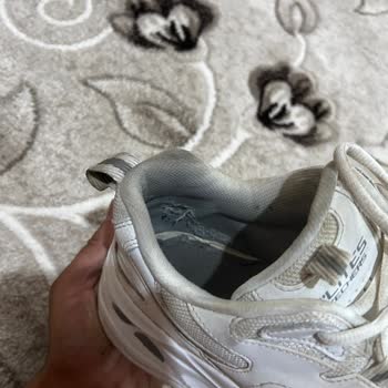 Skechers 1.5 Aylık Ürünün Arkasında Durmuyor