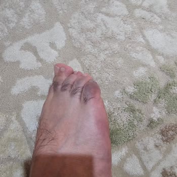 Deichmann Terlik Ayağımı Boyuyor!