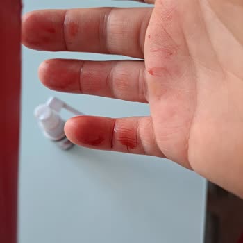 Valens İlaç Akıtıyor Sprey Kullanılamıyor